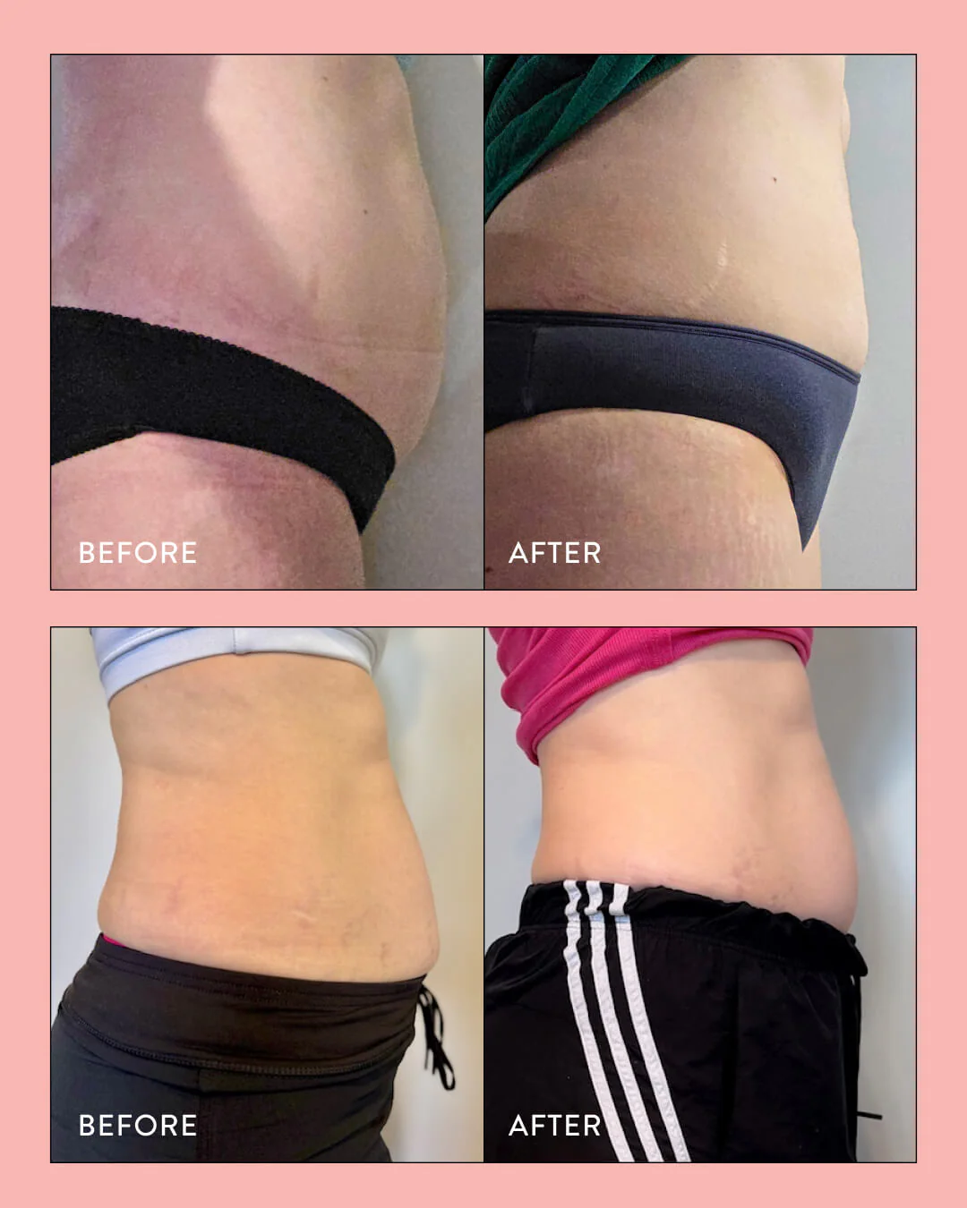 28 Day Gut Reset Bundle - Image 9
